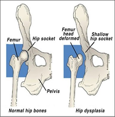 Locating the genes for hip dysplasia in dogs